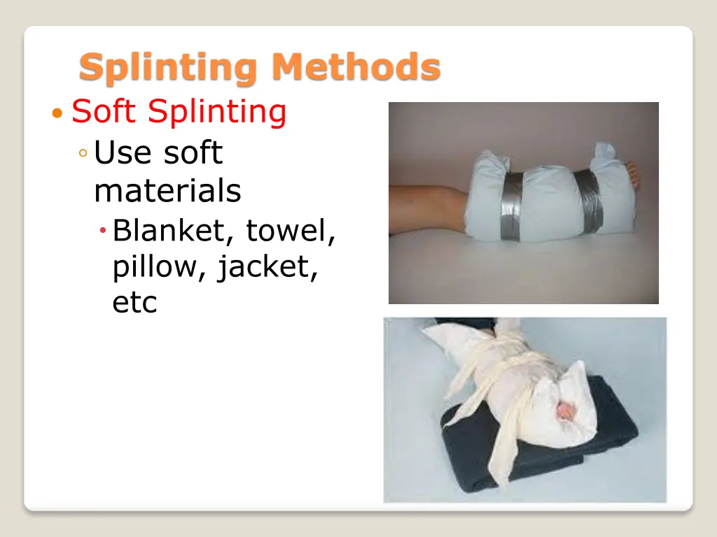 splinting methods soft splinting use soft