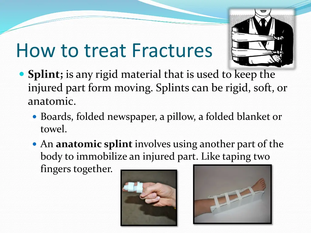 how to treat fractures 1