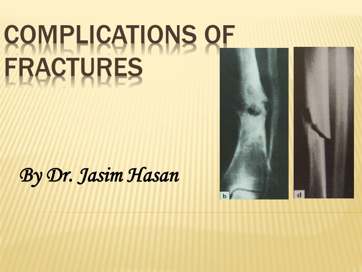 complications of fractures