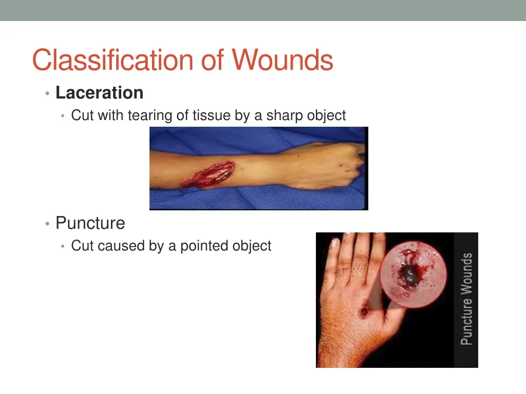 classification of wounds laceration cut with