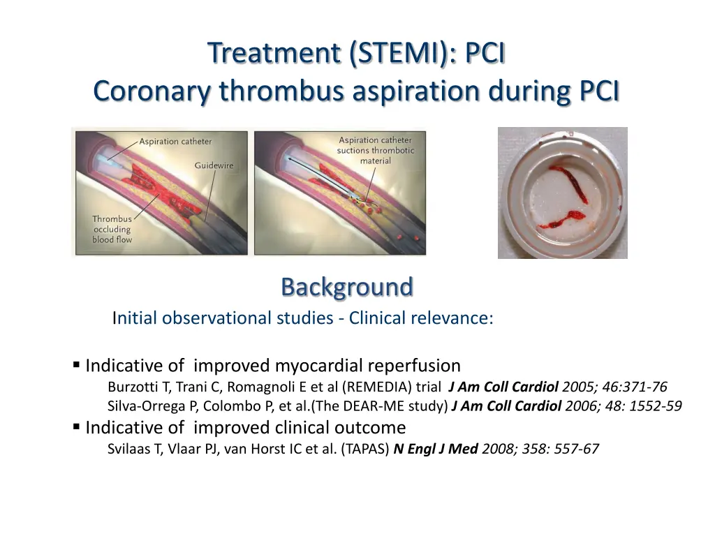 treatment stemi pci coronary thrombus aspiration