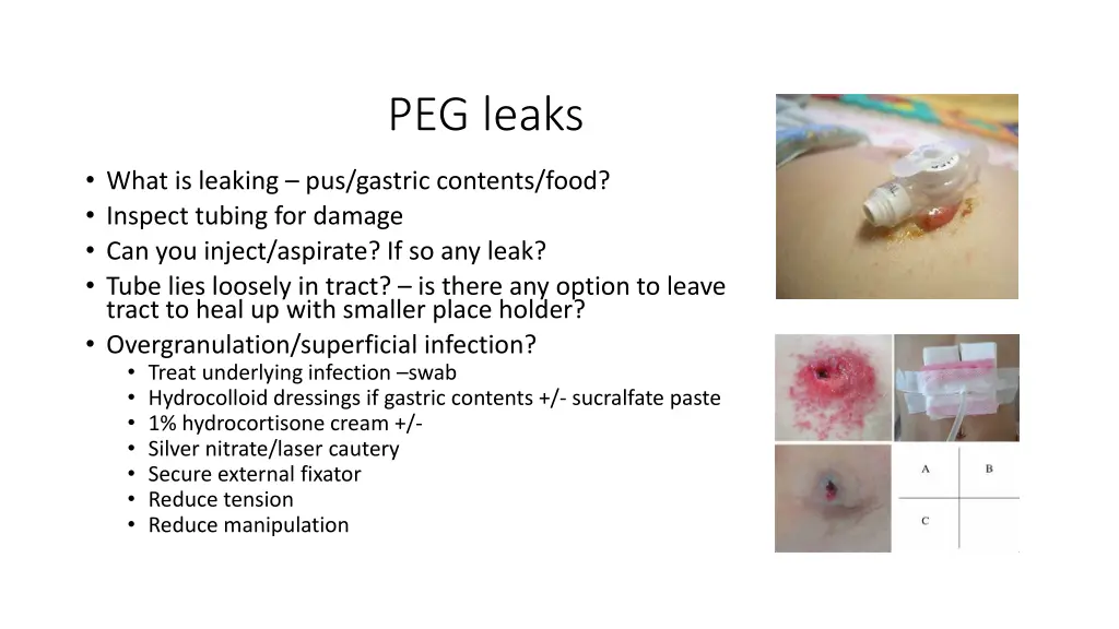 peg leaks