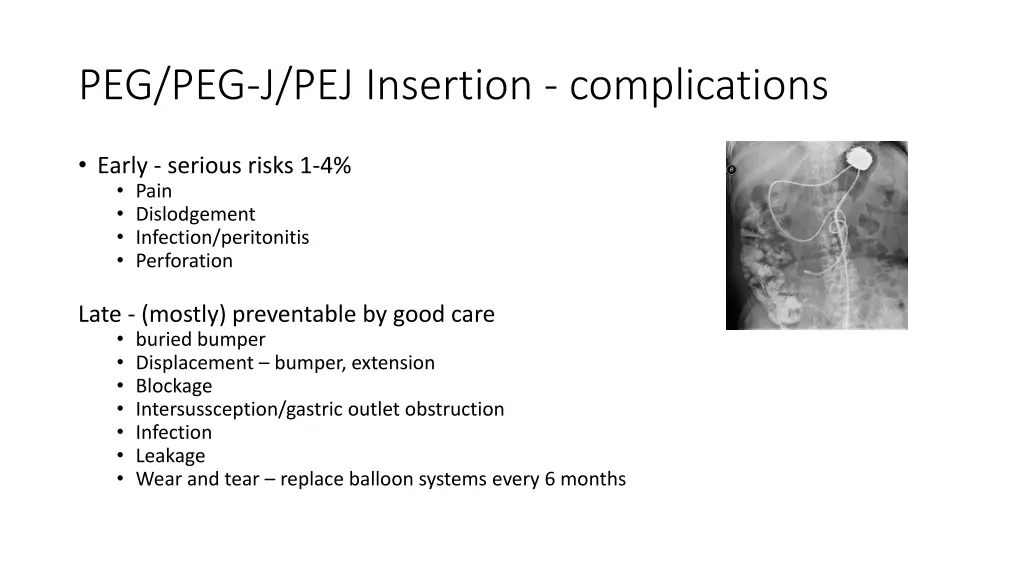 peg peg j pej insertion complications