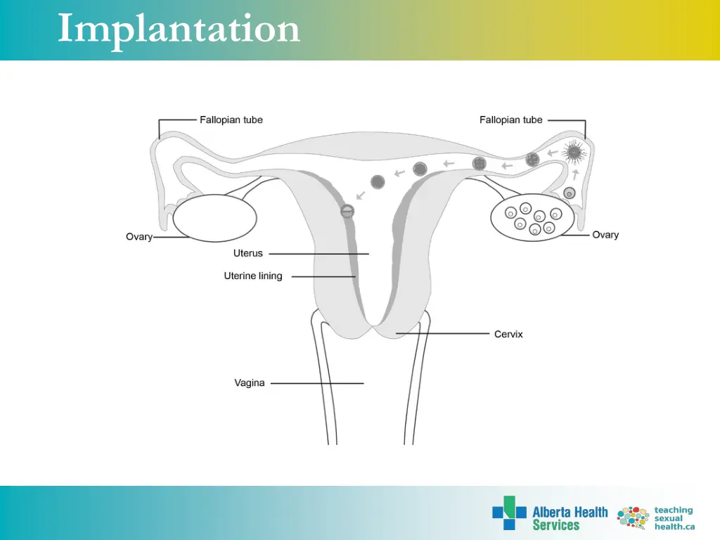 implantation