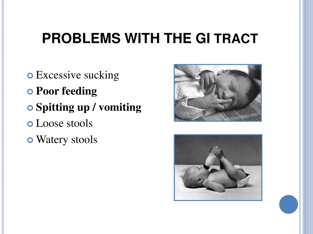 problems with the gi tract