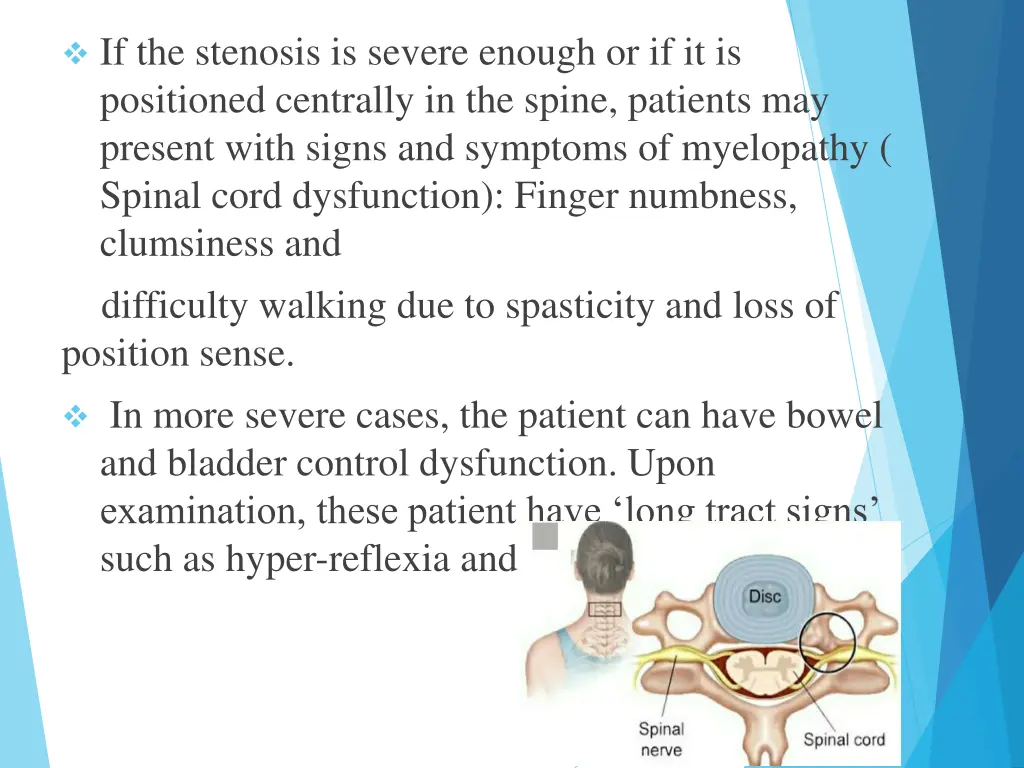 if the stenosis is severe enough