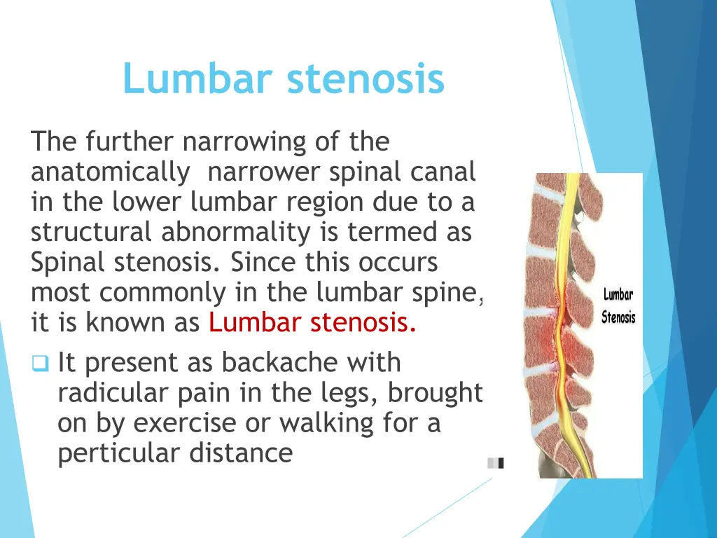 lumbar stenosis