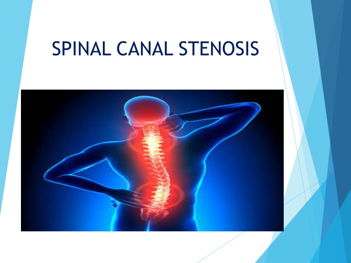 spinal canal stenosis