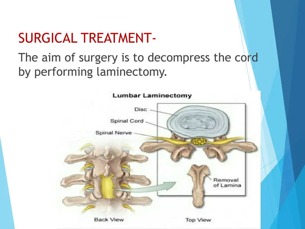 surgical treatment the aim of surgery