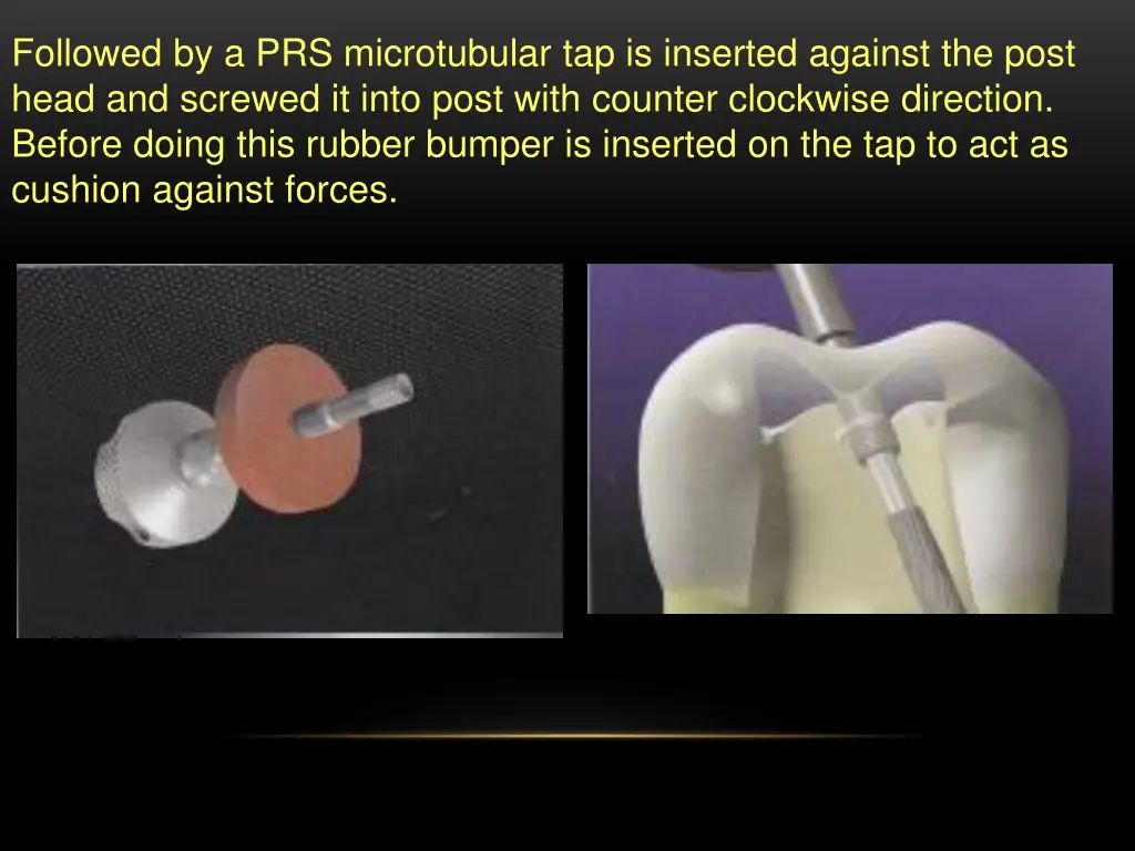 followed by a prs microtubular tap is inserted