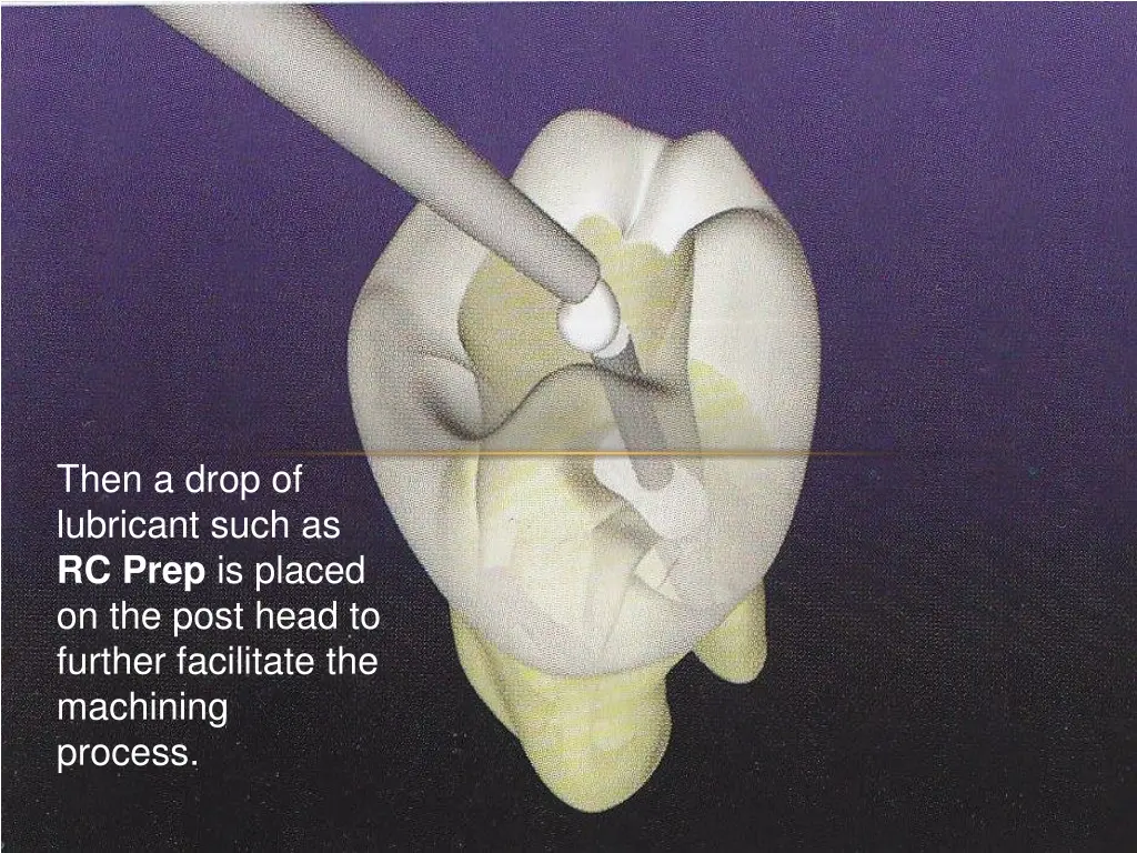 then a drop of lubricant such as rc prep