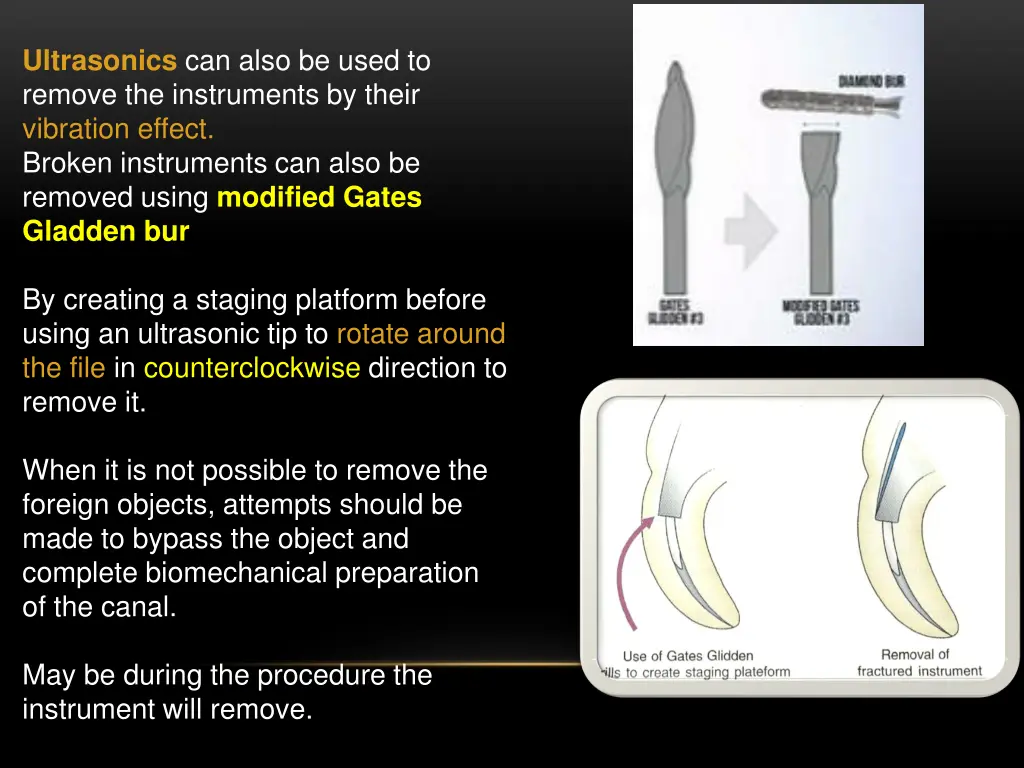 ultrasonics can also be used to remove