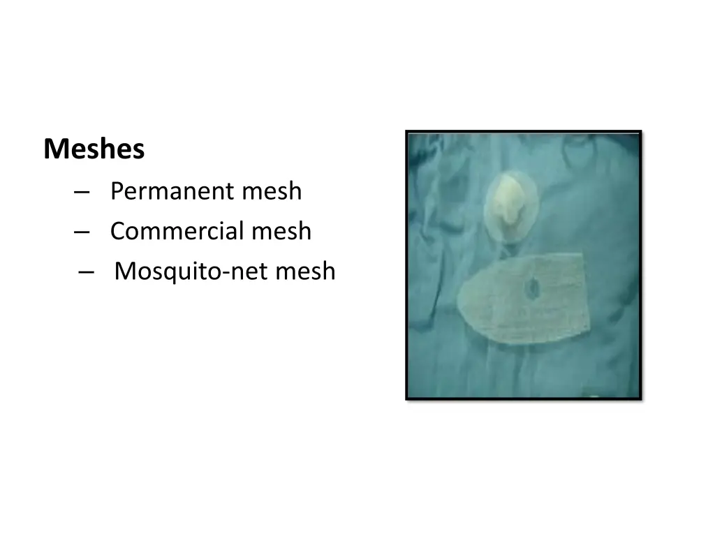 meshes permanent mesh commercial mesh mosquito