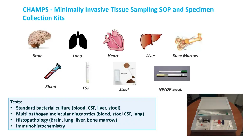 champs minimally invasive tissue sampling