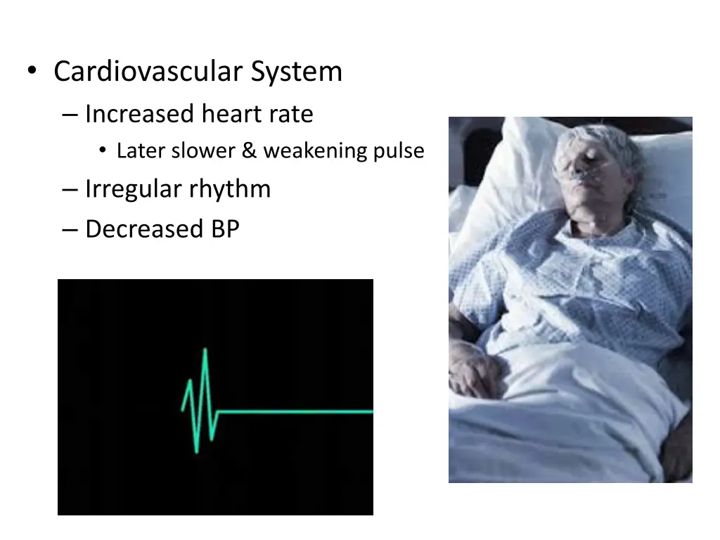 cardiovascular system increased heart rate later