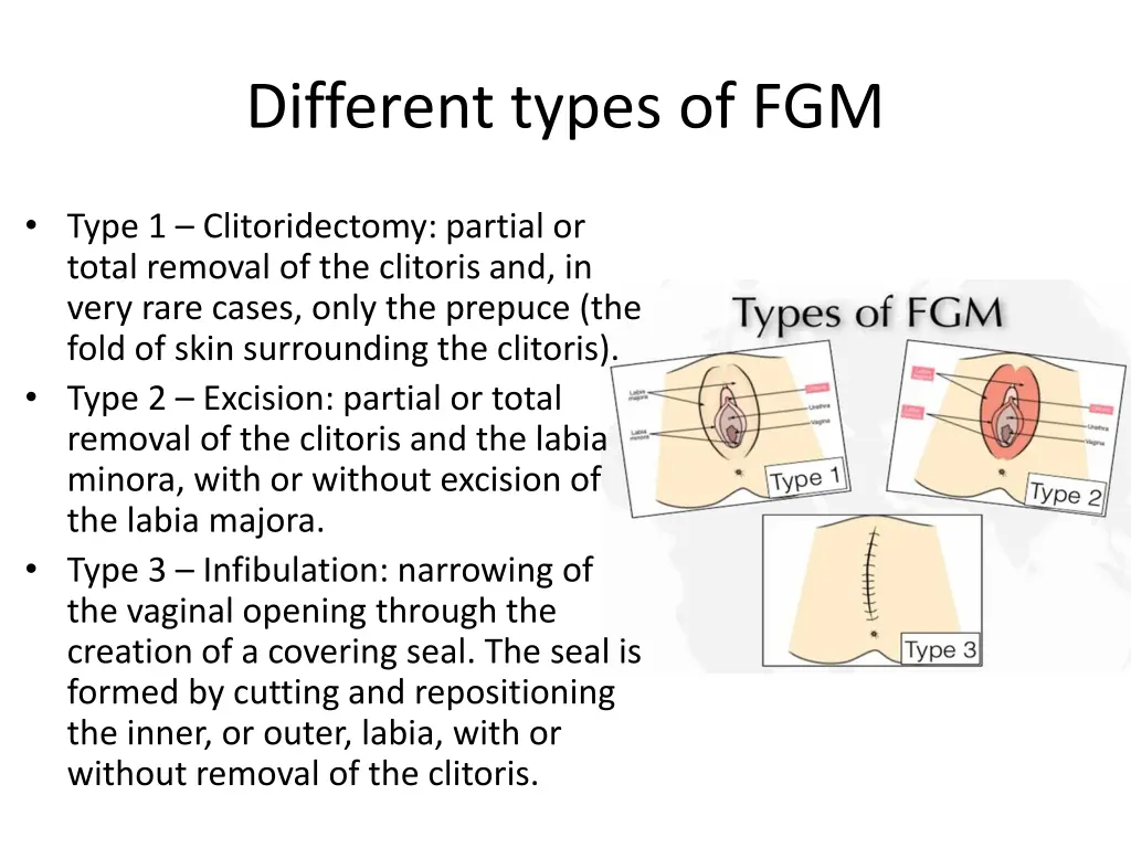 different types of fgm