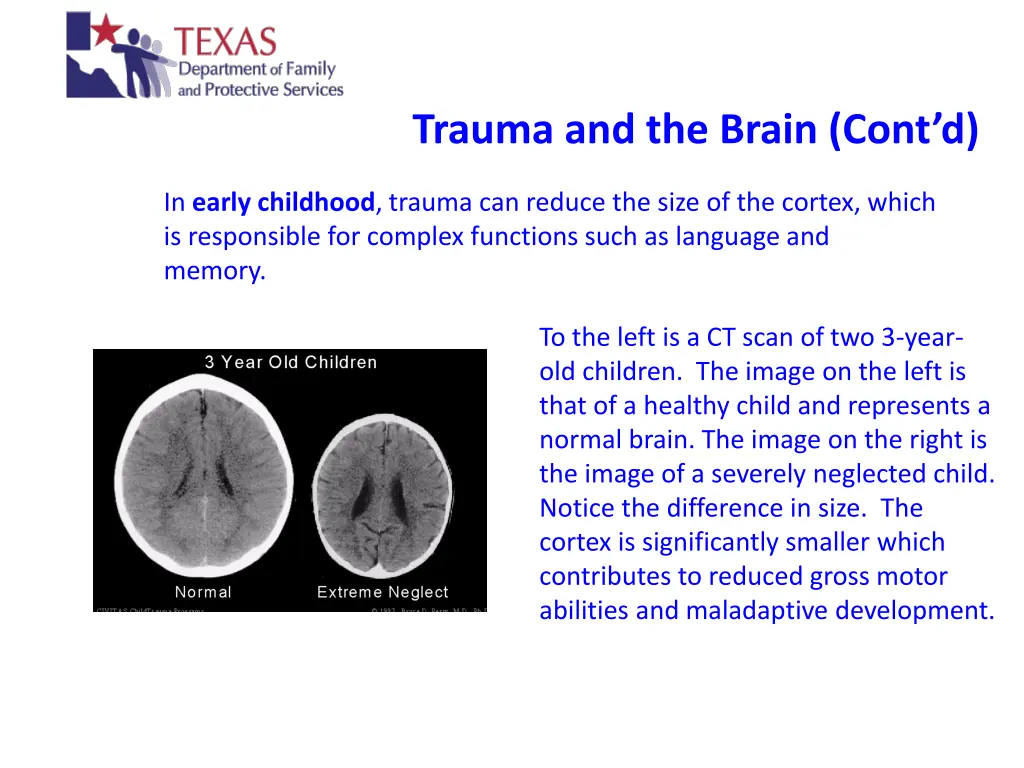 trauma and the brain cont d 2