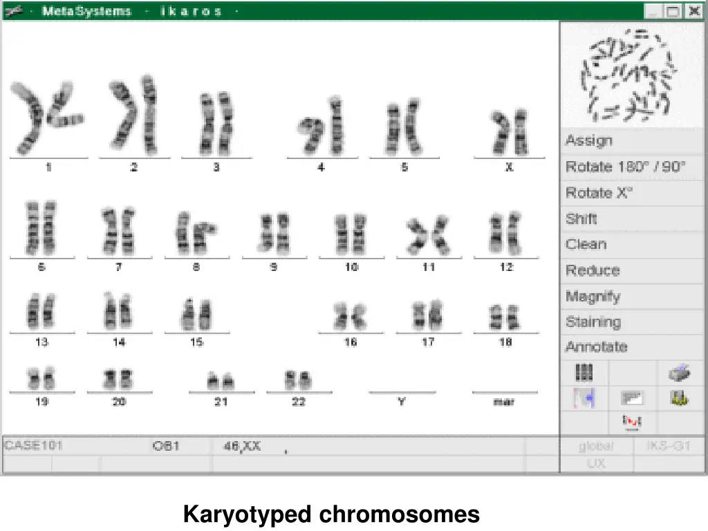 karyotyped chromosomes