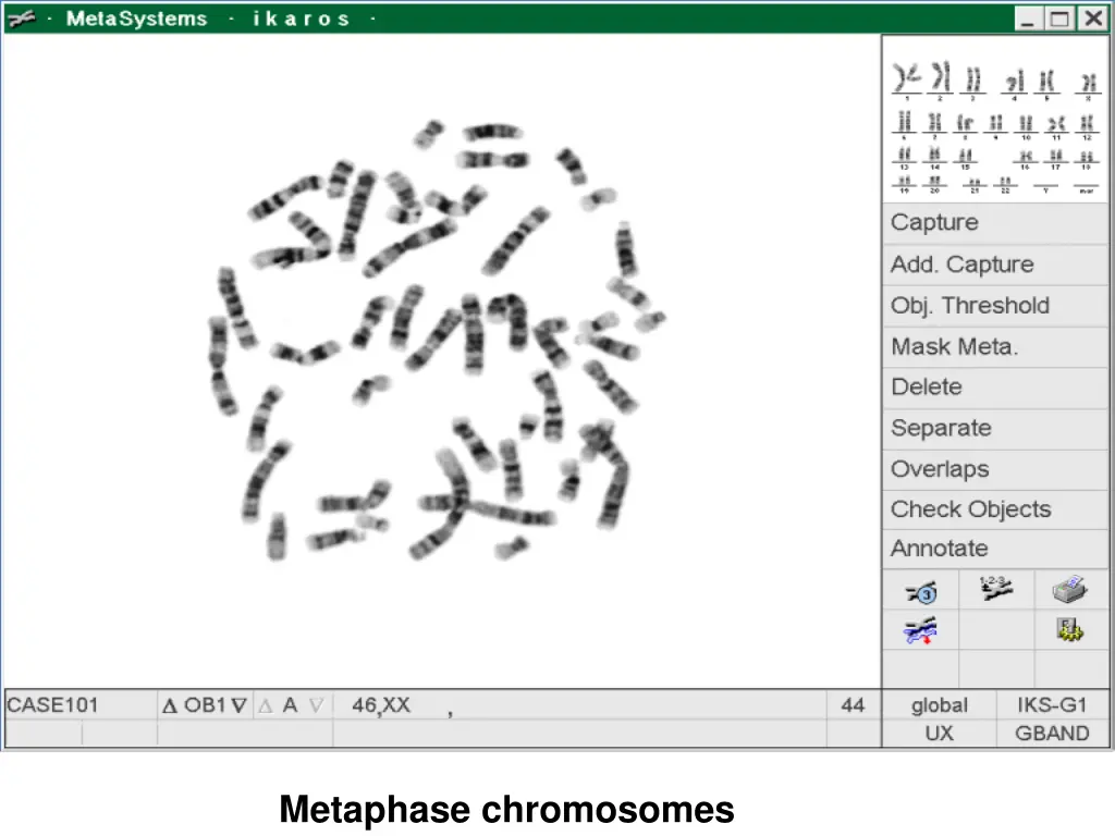 metaphase chromosomes