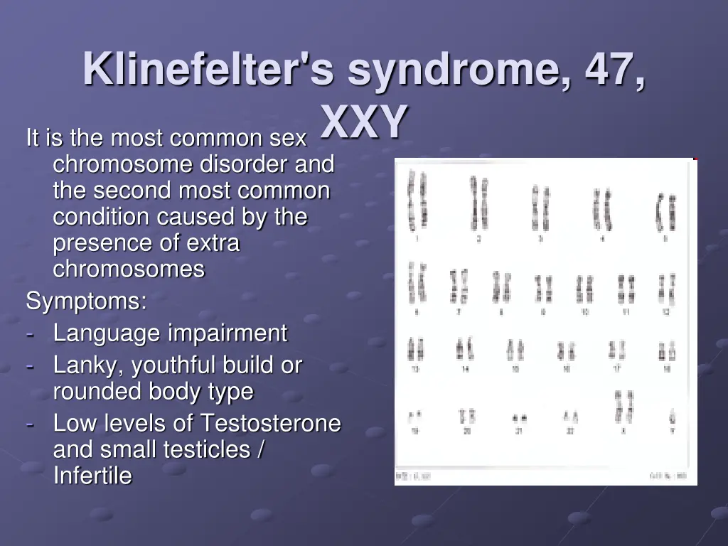 klinefelter s syndrome 47 xxy it is the most