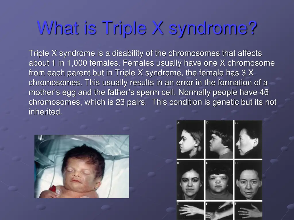 what is triple x syndrome