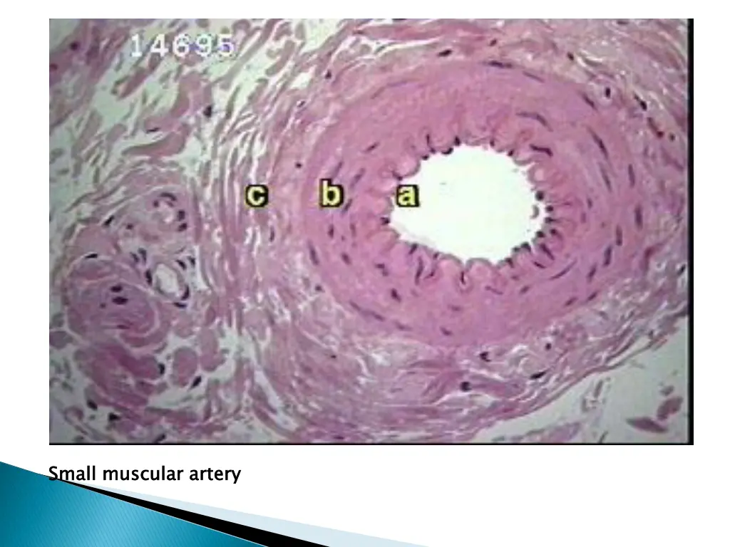 small muscular artery