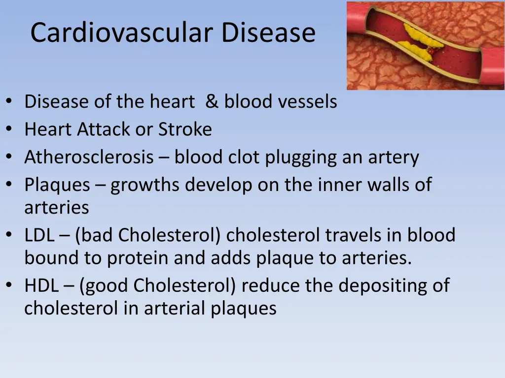 cardiovascular disease