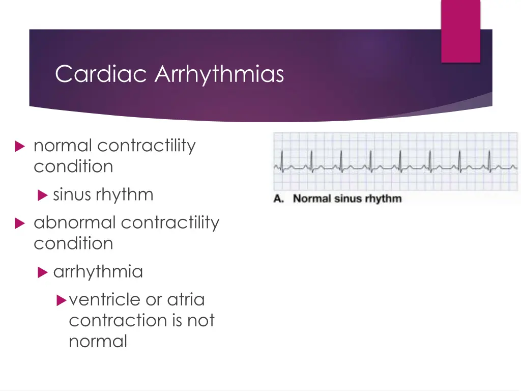 cardiac arrhythmias