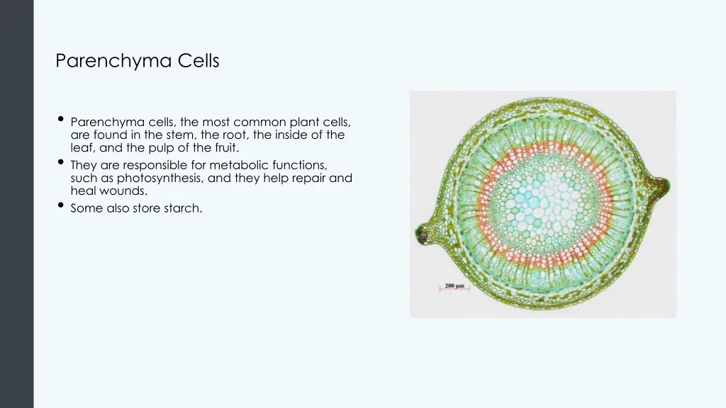 parenchyma cells