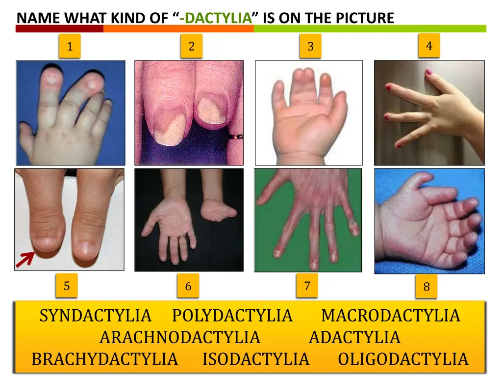 name what kind of dactylia is on the picture