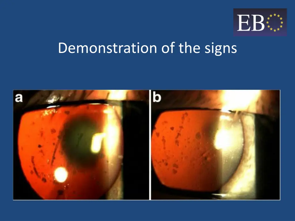 demonstration of the signs