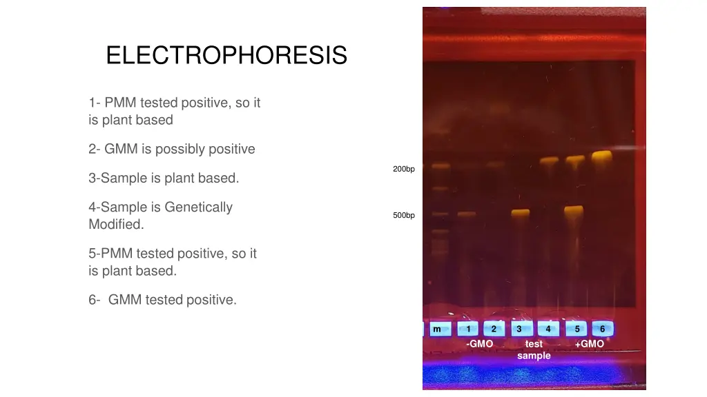 electrophoresis