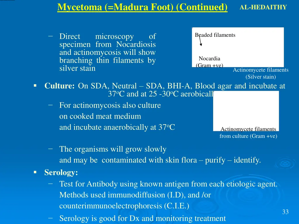 mycetoma madura foot continued 2