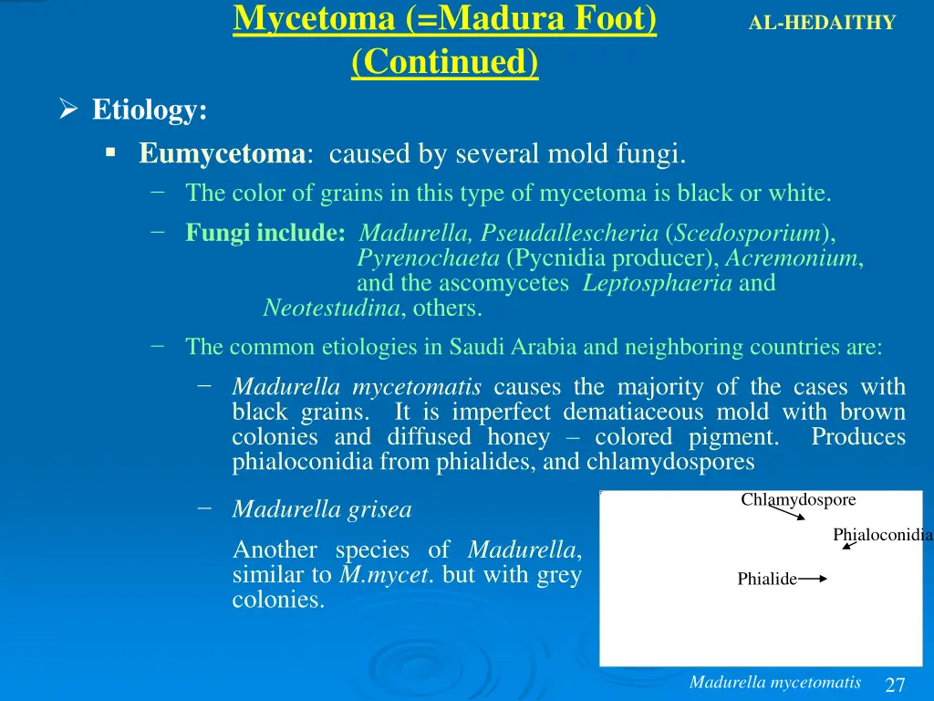 mycetoma madura foot continued