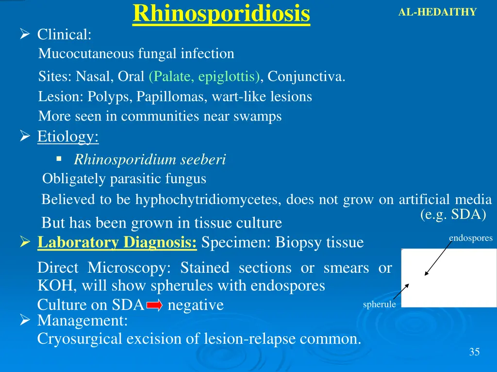 rhinosporidiosis