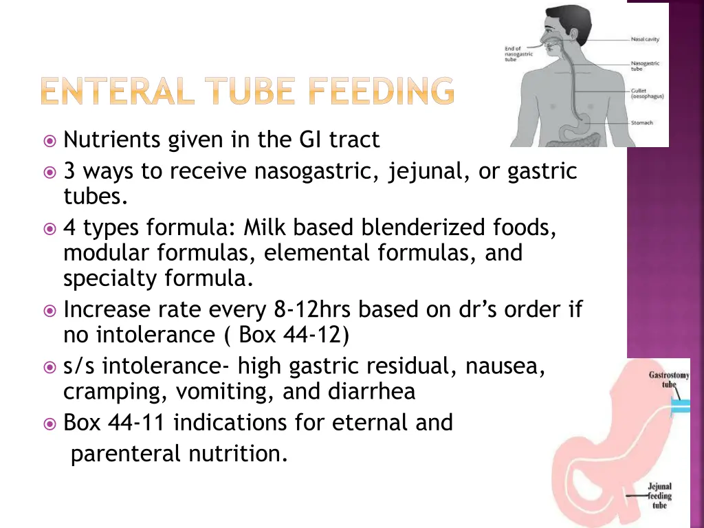 enteral tube feeding