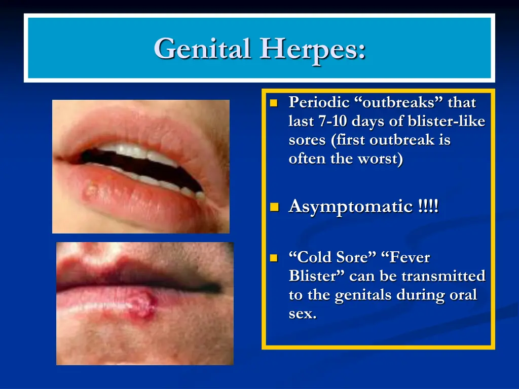 genital herpes