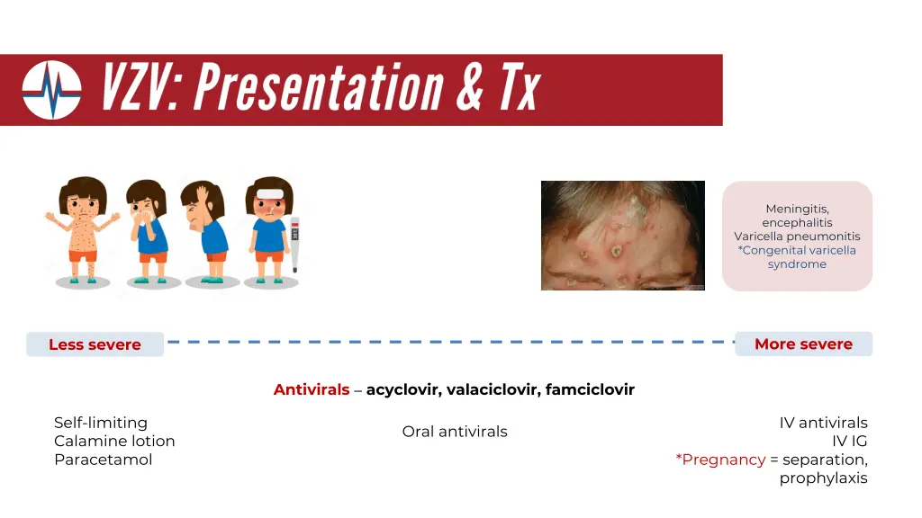 meningitis encephalitis varicella pneumonitis