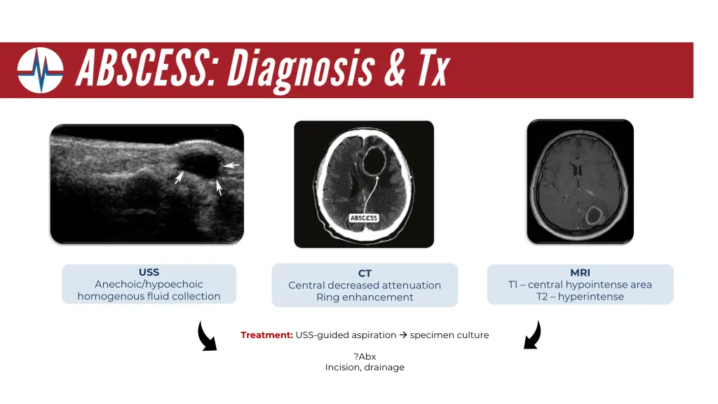 slide32