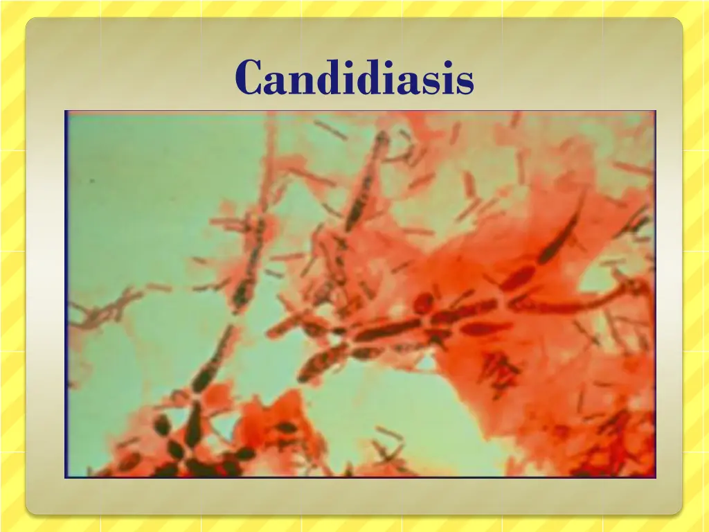 candidiasis 1