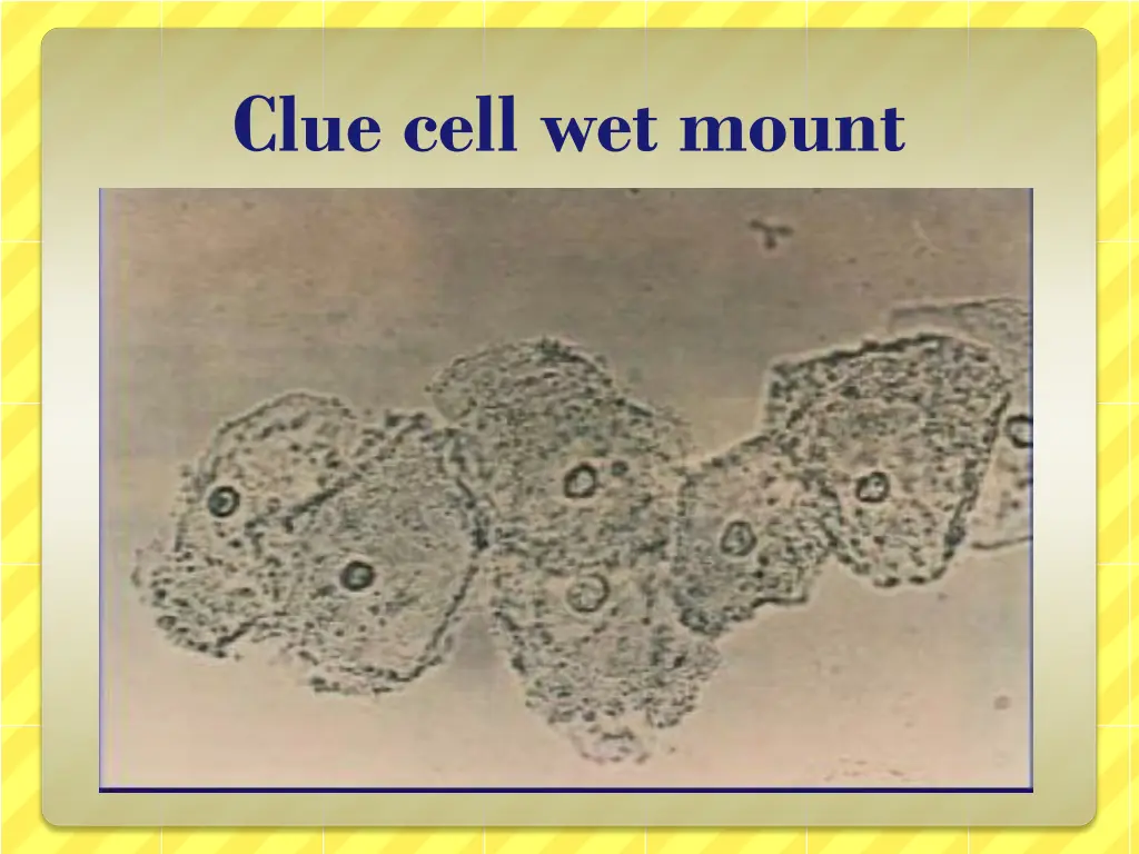 clue cell wet mount