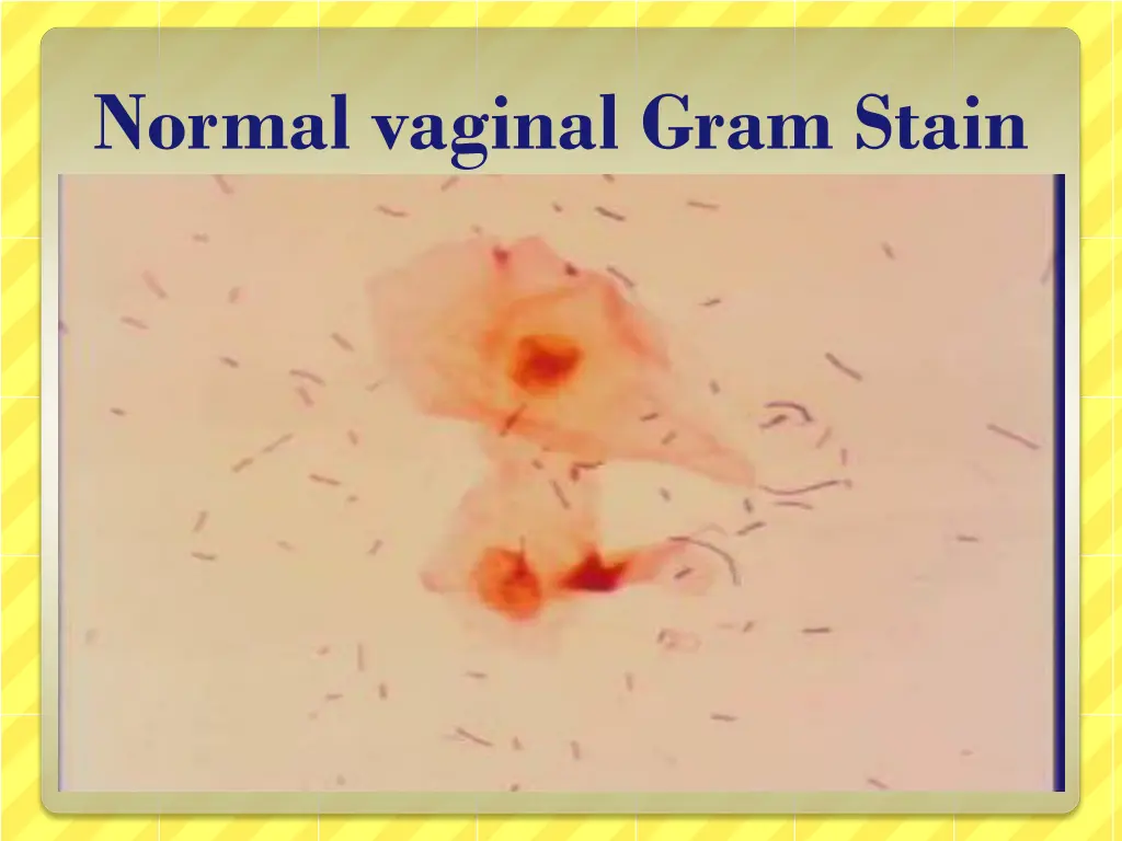 normal vaginal gram stain 1