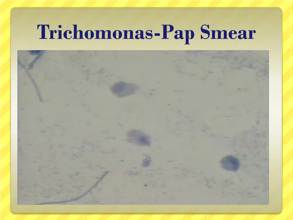 trichomonas pap smear