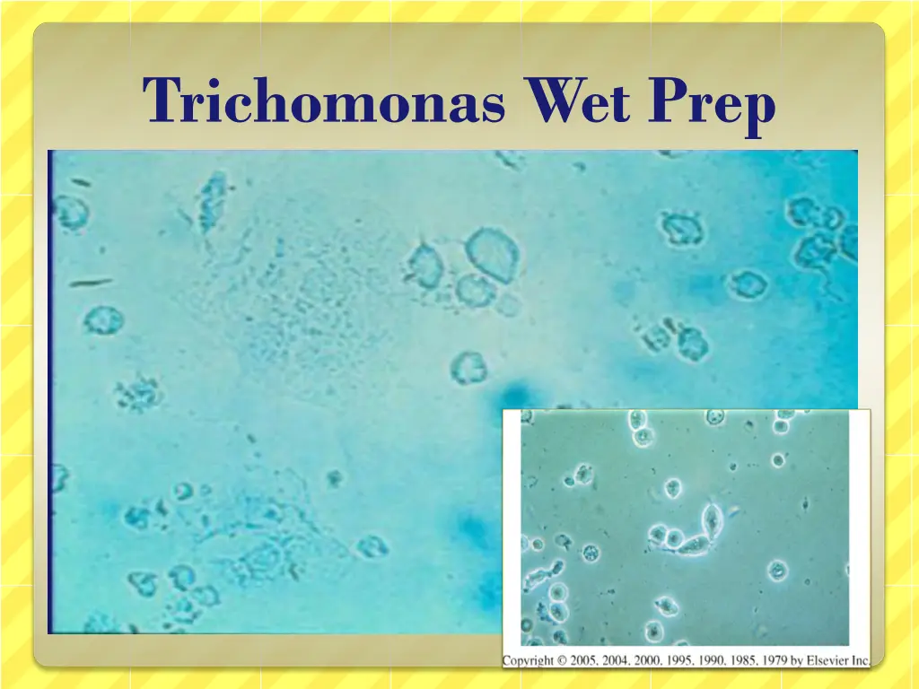 trichomonas wet prep