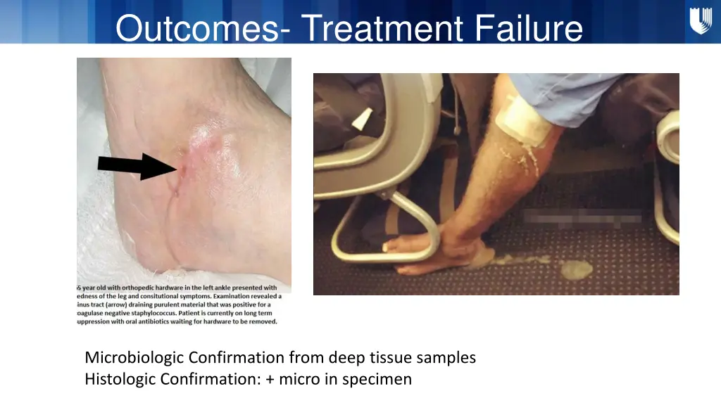 outcomes treatment failure