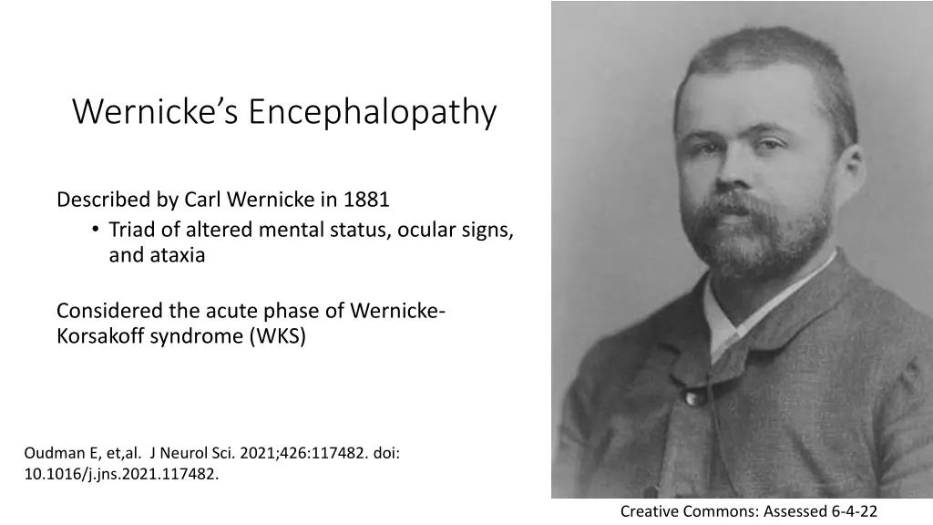 wernicke s encephalopathy