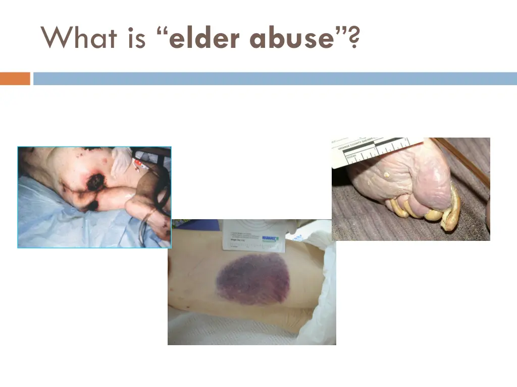 what is elder abuse