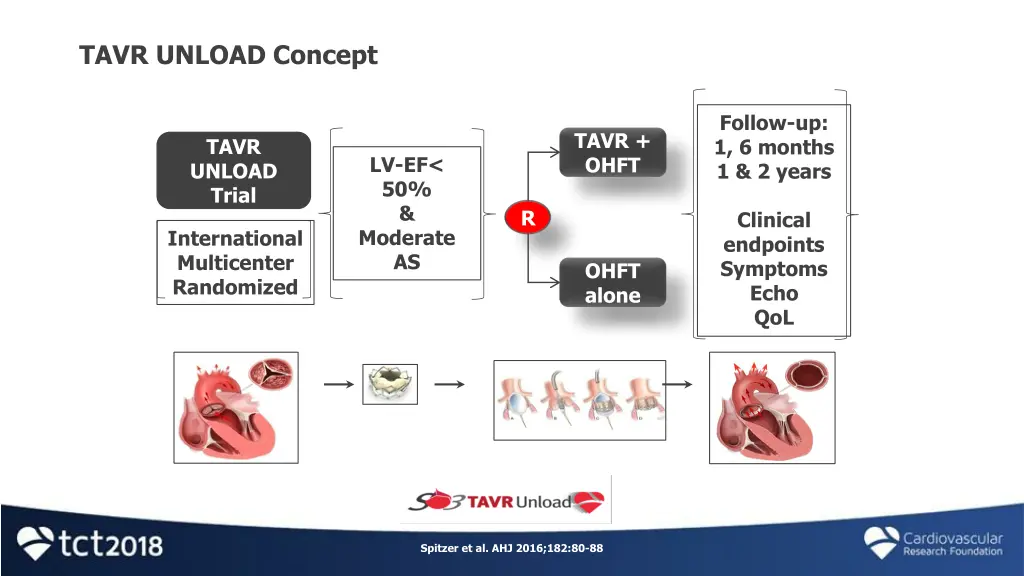 tavr unload concept