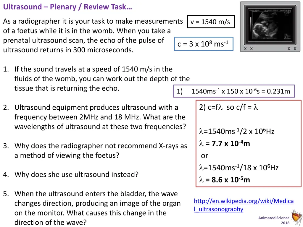 ultrasound plenary review task 1