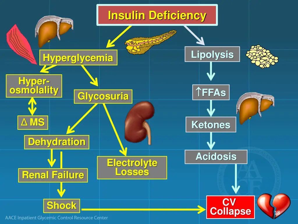 insulin deficiency 2